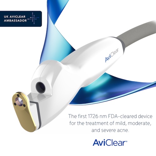 Exclusive AviClear ambassadors for laser acne treatment